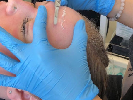 Dermaplaning - Know your treatments series