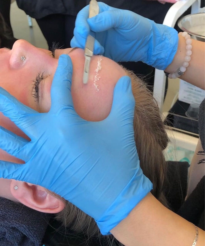 Dermaplaning treatments
