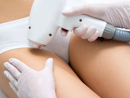 Why laser hair removal is worth the investment