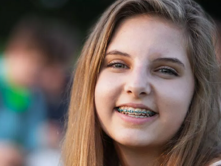 Accelerated Orthodontics: Get To Your New Smile Faster