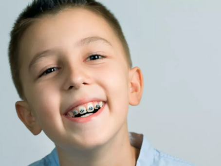 Orthodontics For Young Children