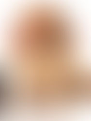 Best Dog Plaque Removers : Dog Dental Care