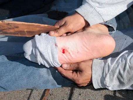 Tetanus with complete immunization record