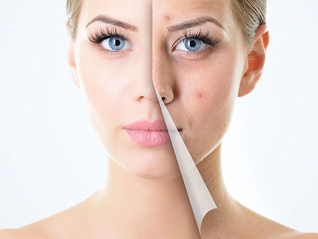 Easy Cosmetic Treatments For Radiant Skin