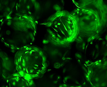 Microcarriers_foto2.png