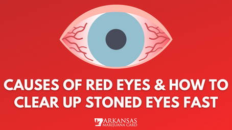 Causes of Red Eyes & How to Clear Up Stoned Eyes