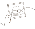 ultrasound vector art_edited.png