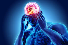 headpain.jpeg