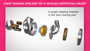 BiVACOR's fully mechanical heart, utilizing technology similar to that of high-speed rail systems