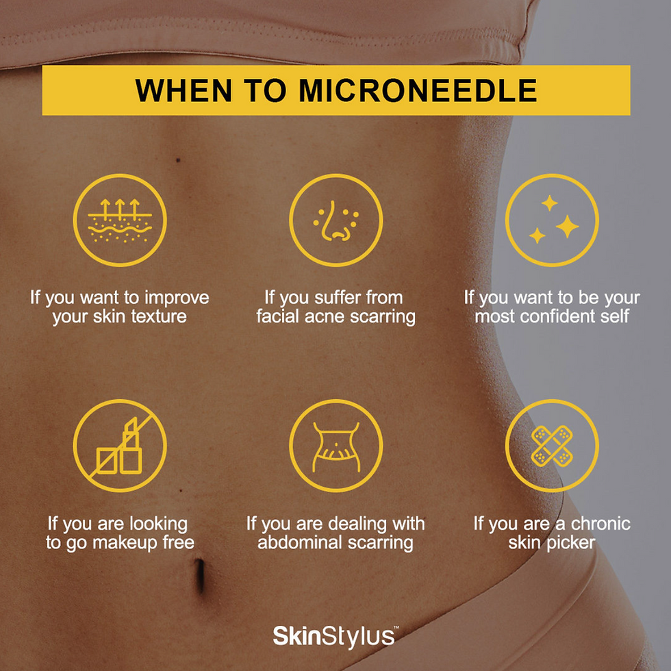 Best Microneedling Midlothian VA Haven Room Spa And Wellness best-microneedling-midlothian-va-haven-room-spa-and-wellness
