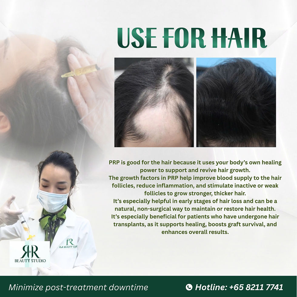 Before and after PRP hair loss treatment in Ho Chi Minh City at R&R Beauty Clinic