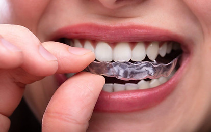 grinding-teeth-mouthguard-1200x800.jpg