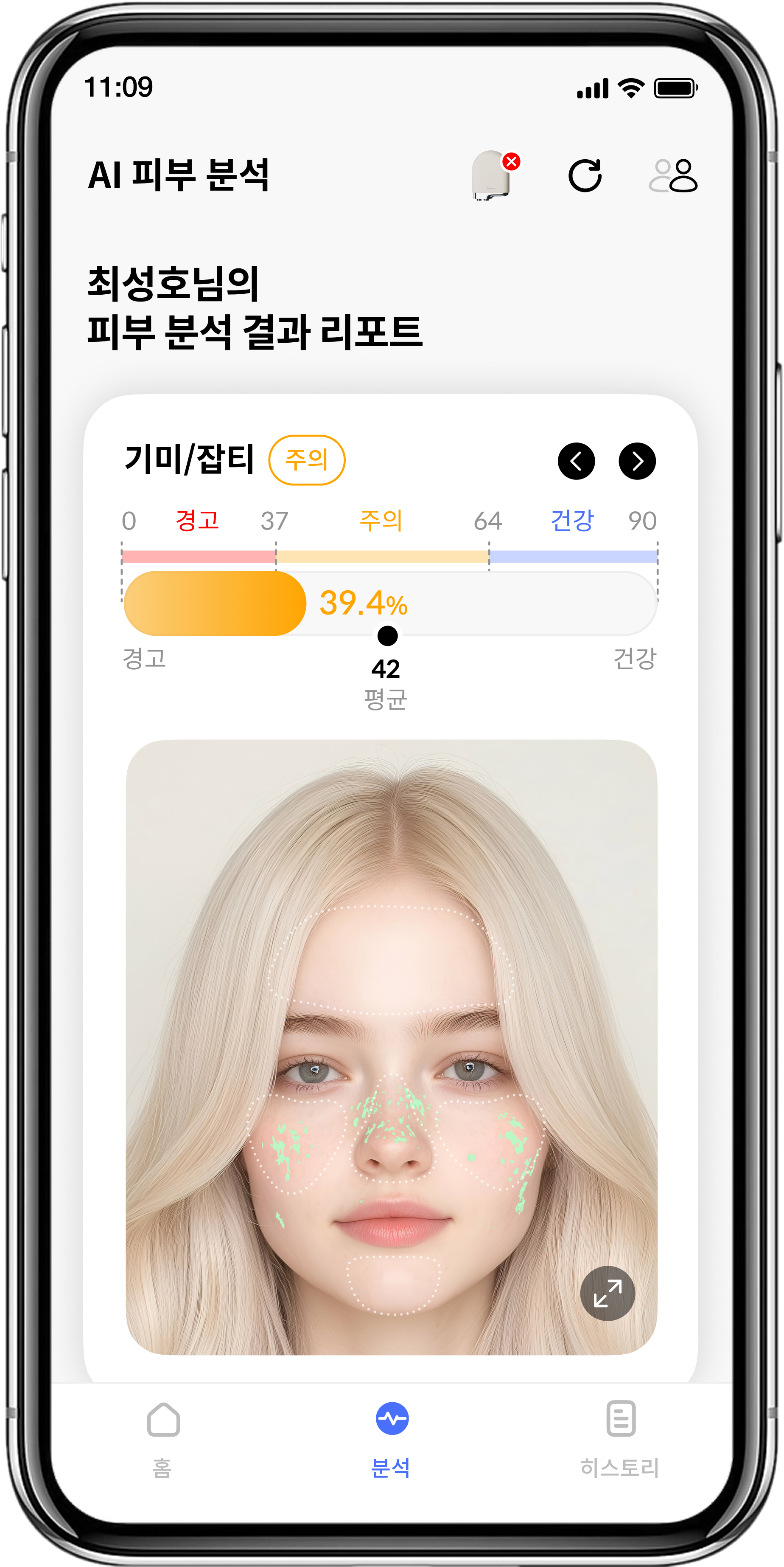 비컨 피부 분석 모바일 목업.png