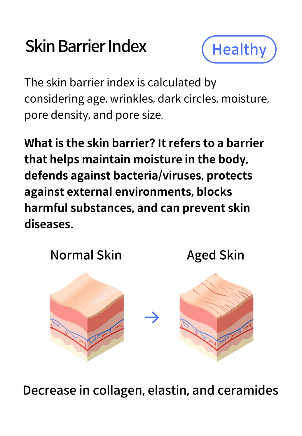 Barrier Index Analysis