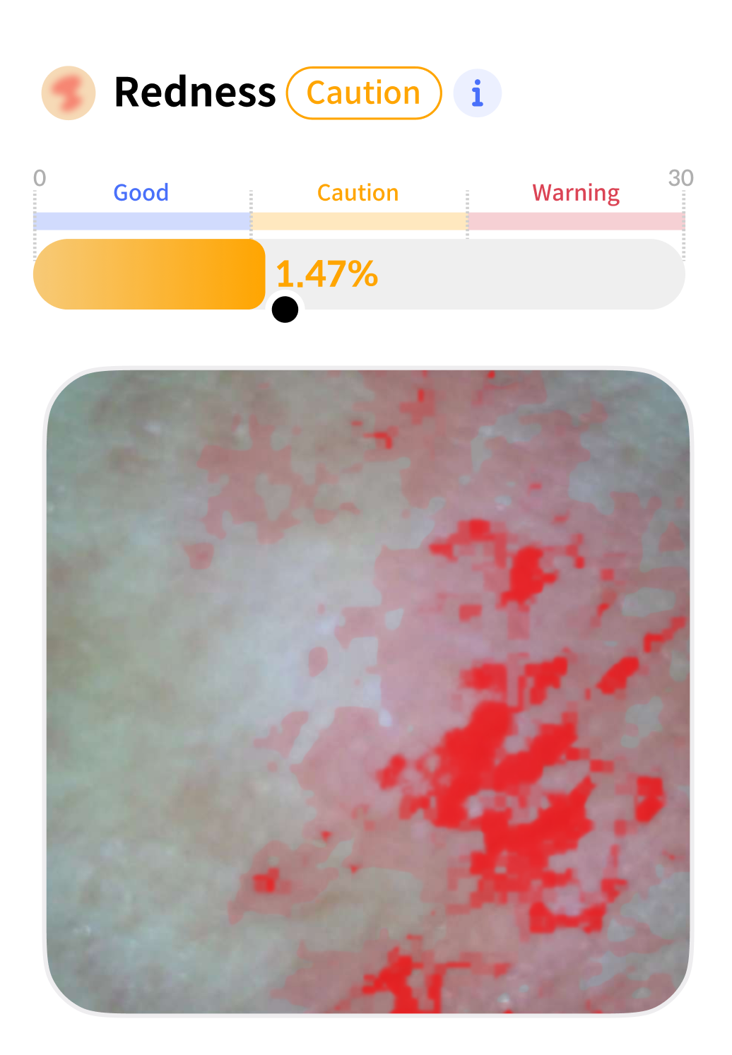 Redness Analysis
