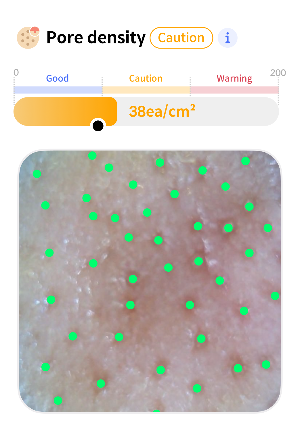 Pore Density Analysis