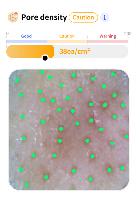 Skin Pore Density Analysis