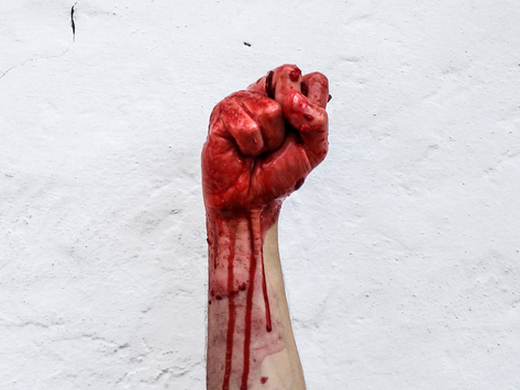 Darkest Day: The Oct 6, 1976 Massacre In Bangkok, Thailand