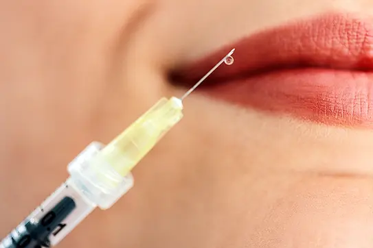 hyaluronic-acid-lip-fillers.webp