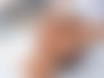 A Importância da Fisioterapia Dermatofuncional no tratamento de feridas: Abordagens e Benefícios