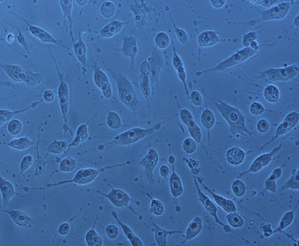 Slide 12_hypotonic.png