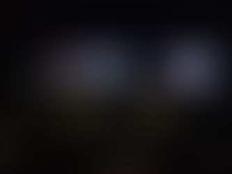 Braces vs Aligners: Which Is Right for You?– A Guide by Dr.Vijay Soni, Dentist in Ujjain