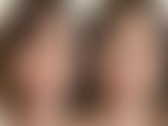 小顔特別キャンペーン実施中♪