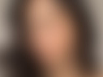 Pele mais oleosa: o que a rotina pode influenciar