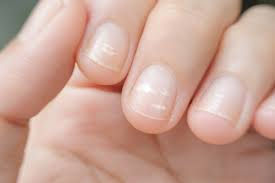 Manchas nas unhas: quando vale investigar?