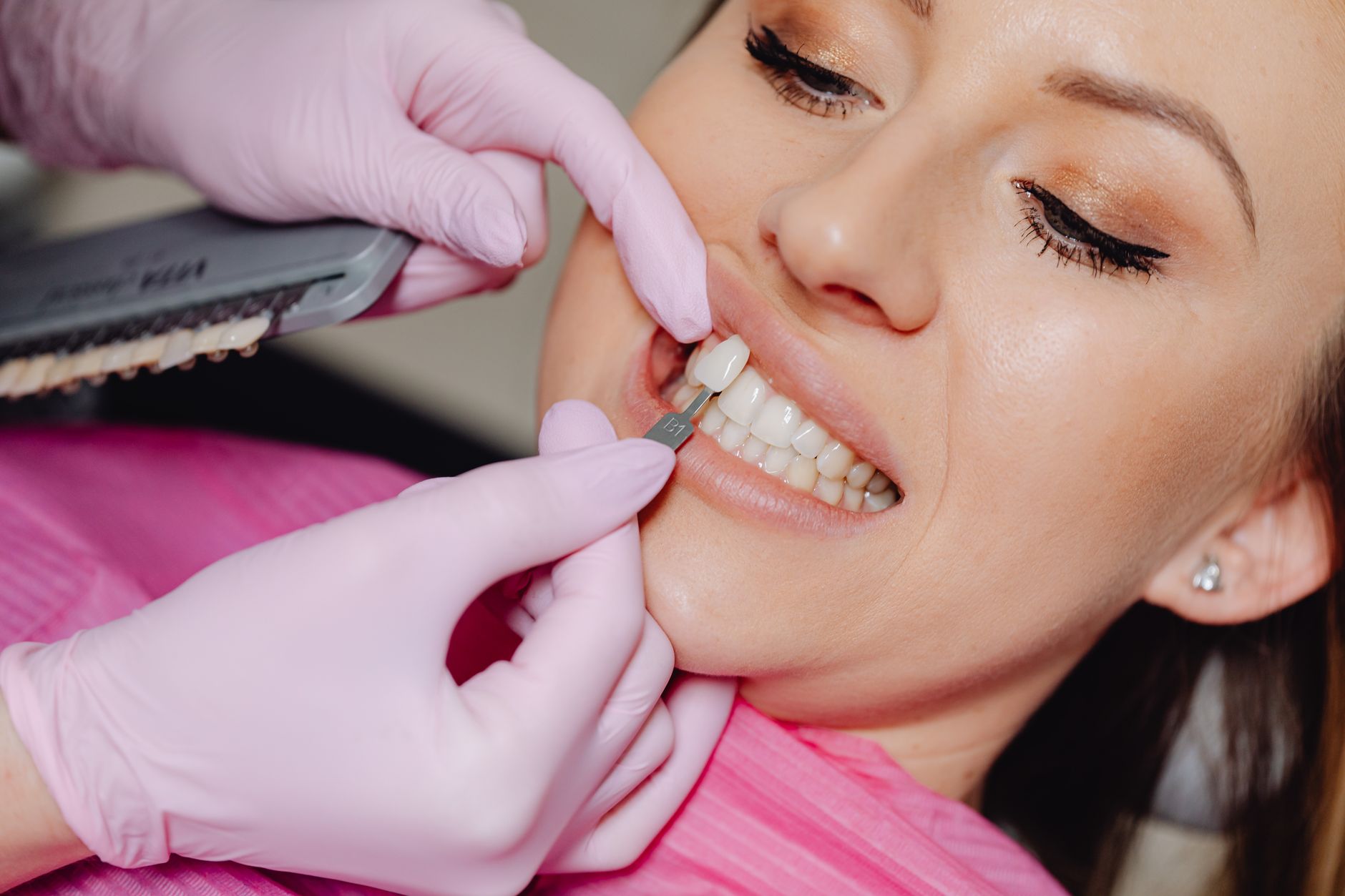 Composite Veneers vs. Porcelain Veneers: How to Know Which One Is Actually Right for You