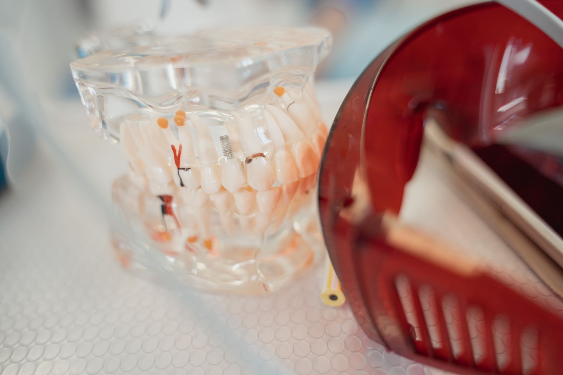 Dental Implants or Dentures? Here's How to Think Through the Decision