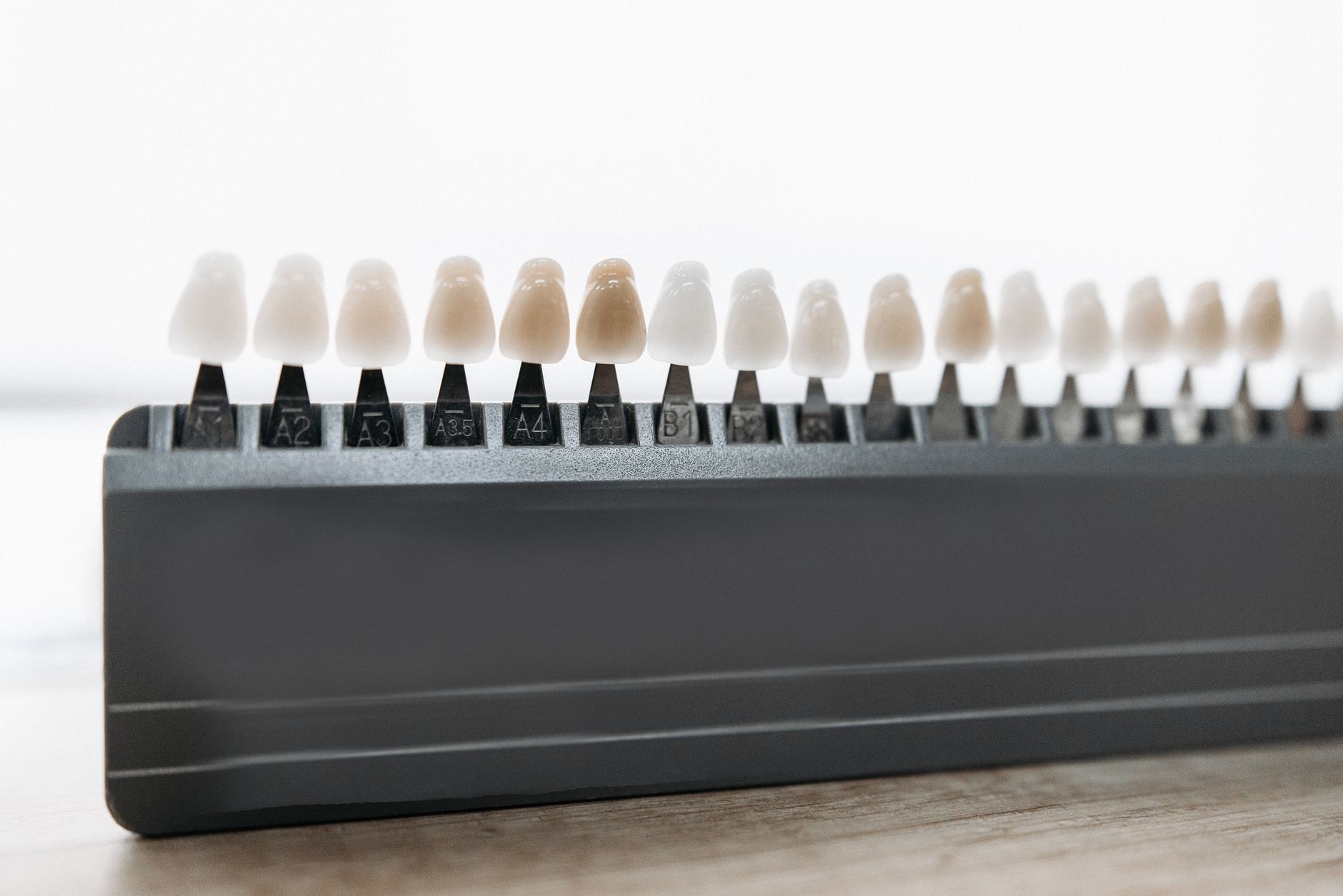 What Porcelain Veneers Actually Feel Like to Wear: A Patient's Honest Guide