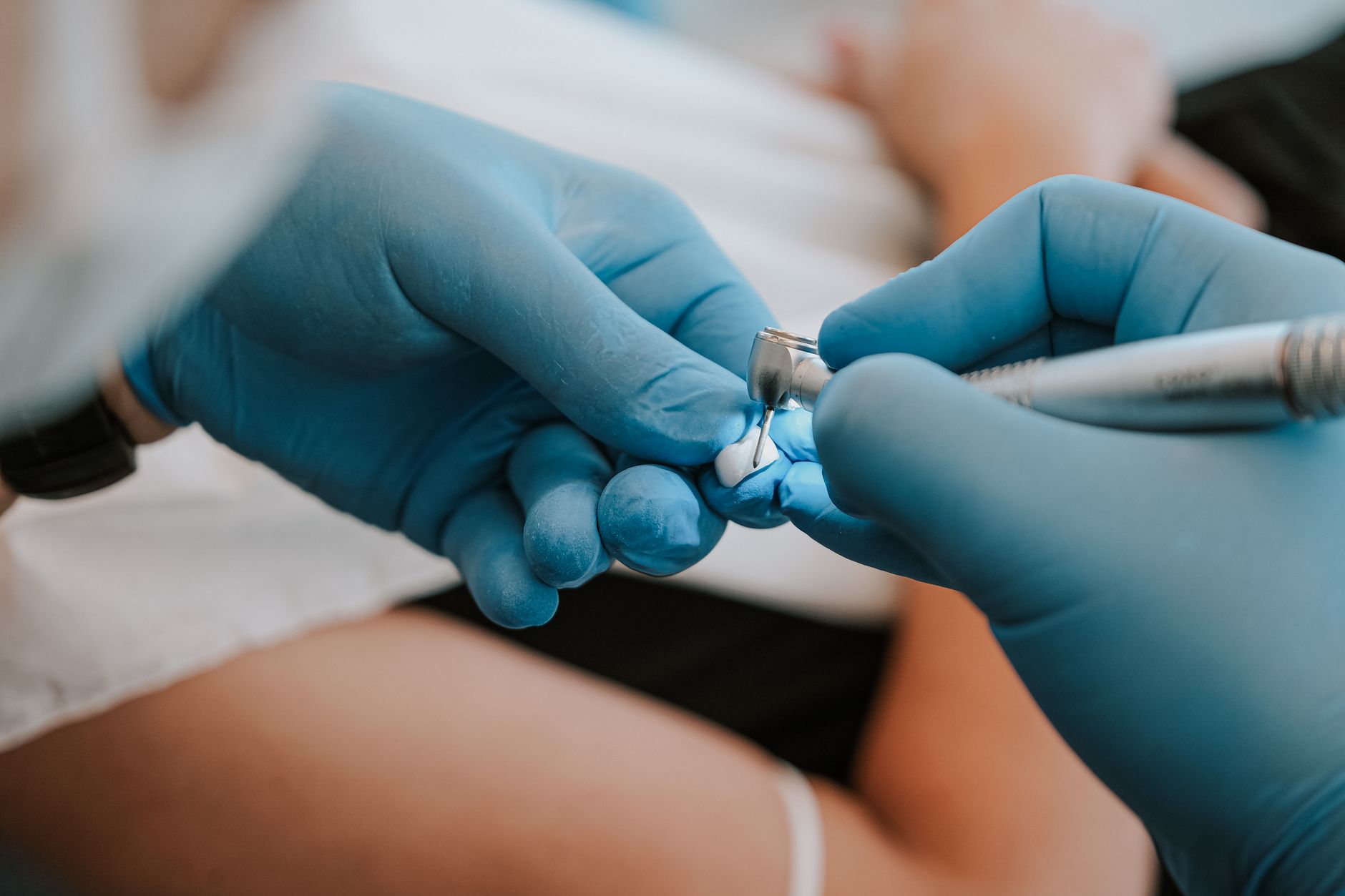 Corrective Jaw Surgery: What It Actually Fixes (and Why Your Dentist, Not Just Your Mirror, Knows You Need It)