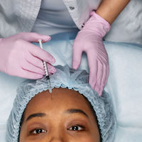 Why Your Dentist Offers Botox and Fillers (And Why It Actually Makes a Lot of Sense)