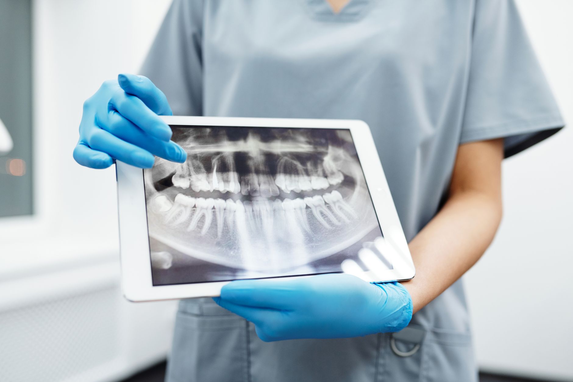 Your Tooth Is Trying to Tell You Something: 7 Signs It Might Need a Root Canal