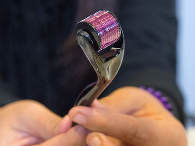 PECM & Aesthetic Microneedle and Cannula Devices