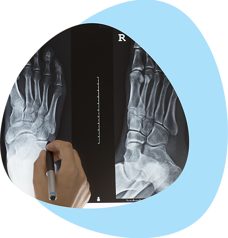 Doctor looking at x-ray of foot
