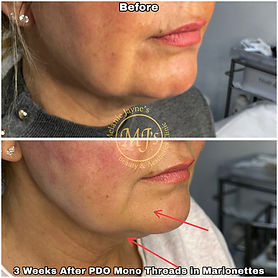 PDO Mono Threads.JPEG