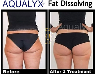 Fat Dissolving saddle bags.JPEG
