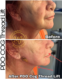 PDO Cog Threads.JPEG