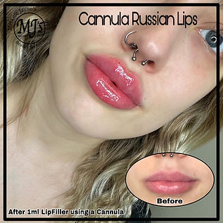 Russian Lips.JPEG