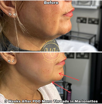 PDO Mono Threads.JPEG