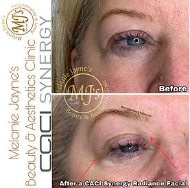 Caci Synergy Radiance eyes.JPEG