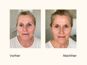 Vorher-Nachher nach einer Gua-Sha-Anwendung nach der Herzlieb-Methode by Clean Beauty Concept – weniger Schwellungen und definiertere Gesichtskonturen.