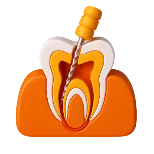 Root Canal Treatment in Singapore