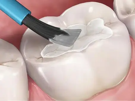 From Dental Anxiety to Relief: Why Eden Prairie Residents Trust Molldrem Family Dentistry in 2025