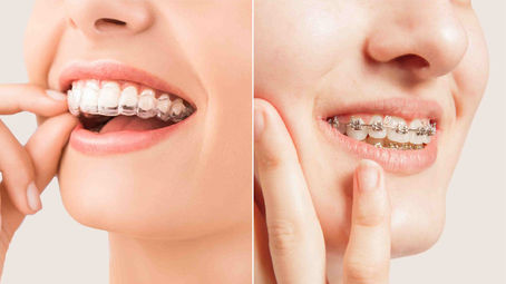 Experience the Precision of Aesthetic Dental Edge's Orthodontic Services