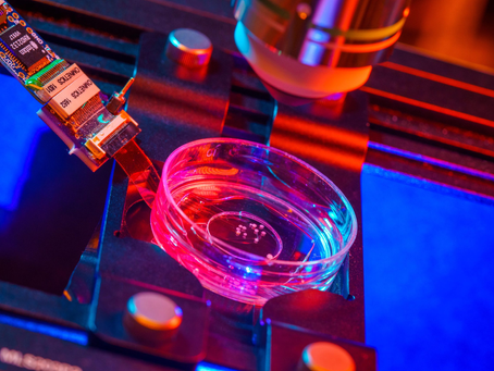 Mini-Brains: Not Just Science Fiction
