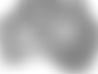 12 Months on and still improving