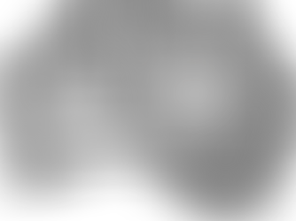 12 Months on and still improving